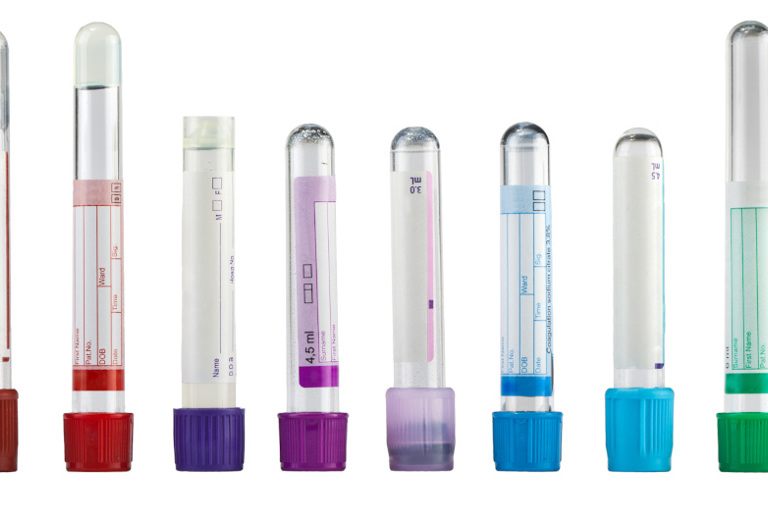 Leere Probenröhrchen mit buntem Deckel