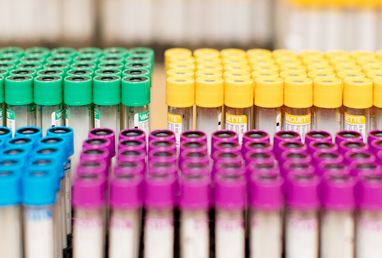 Bunte Röhrchen in farblich sortierten Blöcken